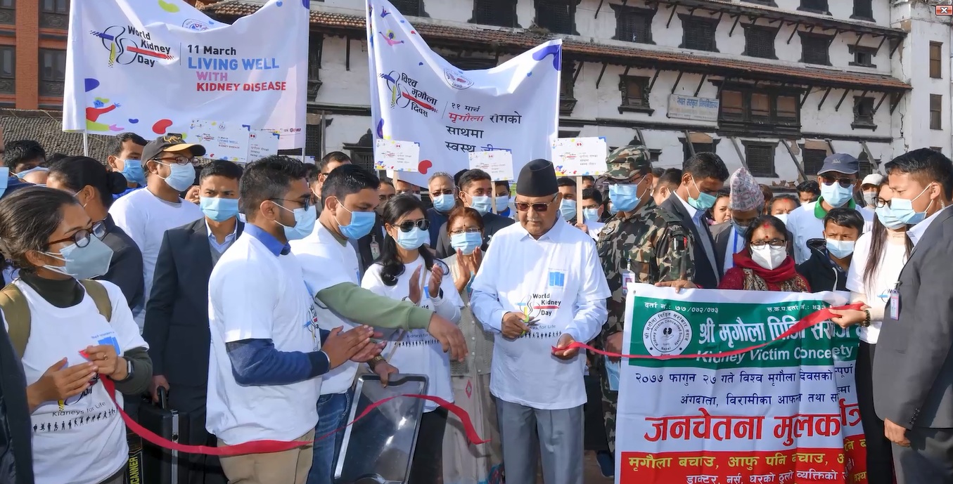 मिर्गौलासम्बन्धी विशेषज्ञ सेवा छिट्टै शुरु हुन्छ : प्रधानमन्त्री ओली